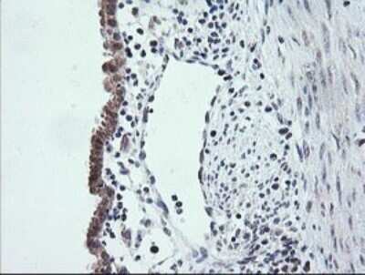 Immunohistochemistry: ETS2 Antibody (OTI2A3) - Azide and BSA Free [NBP2-70694]