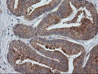 Immunohistochemistry: ETS2 Antibody (OTI2A3) [NBP2-45543]