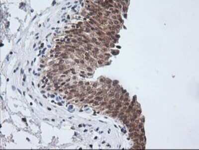 Immunohistochemistry: ETS2 Antibody (OTI2A3) [NBP2-45543]