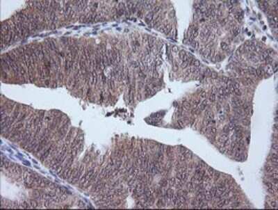 Immunohistochemistry: ETS2 Antibody (OTI2A3) [NBP2-45543]