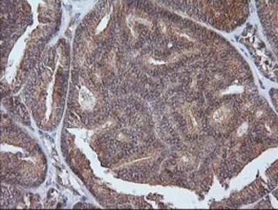 Immunohistochemistry: ETS2 Antibody (OTI2A3) [NBP2-45543]