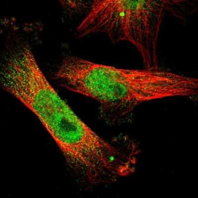 Immunocytochemistry/ Immunofluorescence: ETV3 Antibody [NBP1-80931]