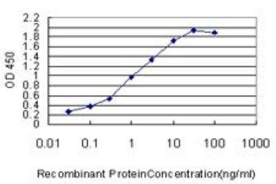 ELISA: ETV5/ERM Antibody (7C10) [H00002119-M02]