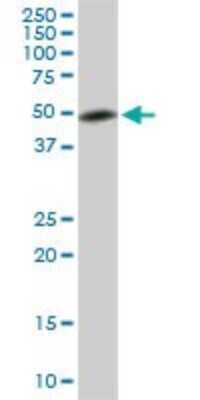Western Blot: ETV5/ERM Antibody (7C10) [H00002119-M02]