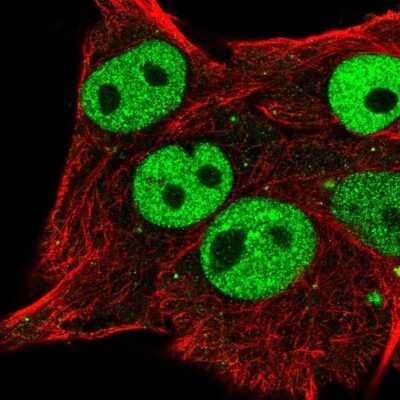Immunocytochemistry/ Immunofluorescence: ETV5/ERM Antibody [NBP2-55689]