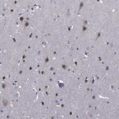 Immunohistochemistry-Paraffin: ETV5/ERM Antibody [NBP3-17656]