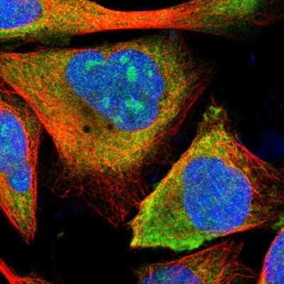 Immunocytochemistry/ Immunofluorescence: ETV6/Tel Antibody [NBP1-80695]