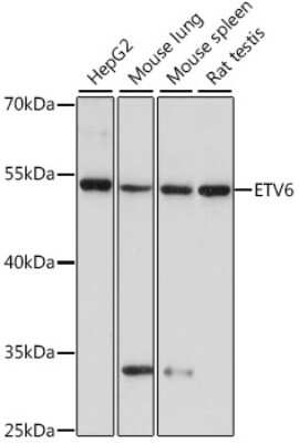 Western Blot: ETV6/Tel AntibodyAzide and BSA Free [NBP3-03434]