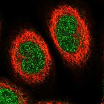 Immunocytochemistry/ Immunofluorescence: ETV7 Antibody [NBP1-80694]