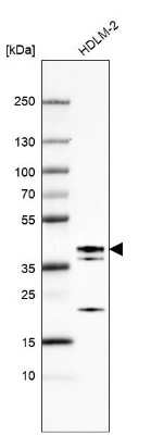 Western Blot: ETV7 Antibody [NBP1-80694]