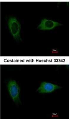 Immunocytochemistry/ Immunofluorescence: EVC2 Antibody [NBP1-31268]