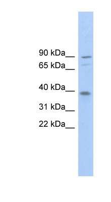 Western Blot: EVER2 Antibody [NBP1-57812]