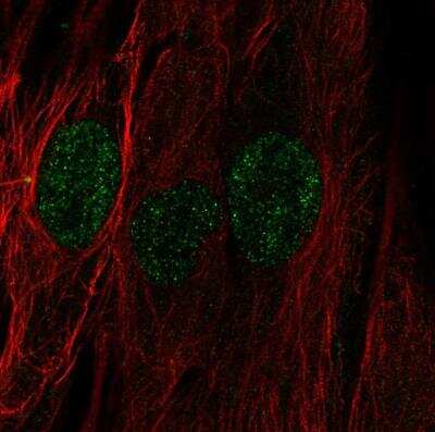 Immunocytochemistry/ Immunofluorescence: EVG1 Antibody [NBP2-76489]