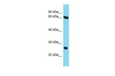 Western Blot: EVG1 Antibody [NBP2-83023]