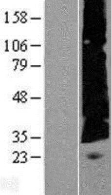 Western Blot: EVG1 Overexpression Lysate [NBP2-05986]