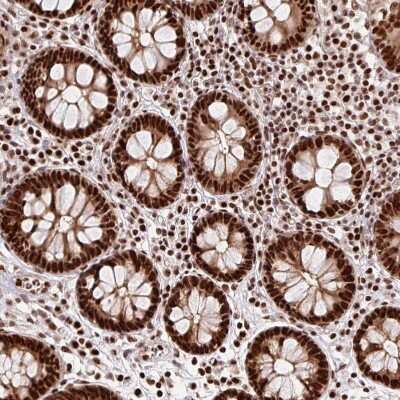 Immunohistochemistry-Paraffin: EVI-1 Antibody [NBP2-48848]