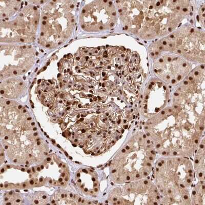 Immunohistochemistry-Paraffin: EVI-1 Antibody [NBP2-48848]