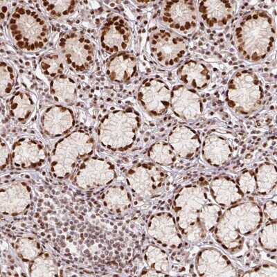 Immunohistochemistry-Paraffin: EVI-1 Antibody [NBP2-48848]