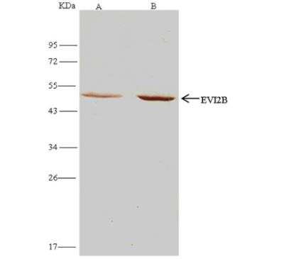 Immunoprecipitation: EVI2B Antibody [NBP2-99056]