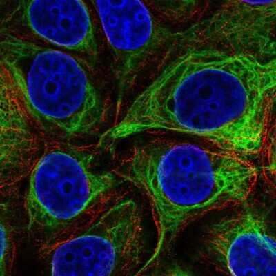 Immunocytochemistry/ Immunofluorescence: EVPL Antibody [NBP2-37940]