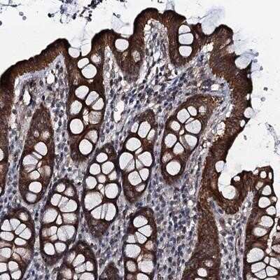 Immunohistochemistry-Paraffin: EVX2 Antibody [NBP1-90973]