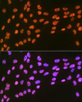 Immunocytochemistry/ Immunofluorescence: EWSR1 Antibody (9G3H1) [NBP3-16845]