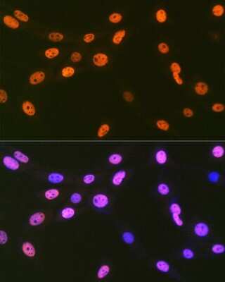 Immunocytochemistry/ Immunofluorescence: EWSR1 Antibody (9G3H1) [NBP3-16845]