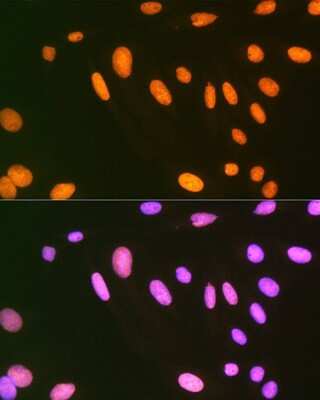 Immunocytochemistry/ Immunofluorescence: EWSR1 Antibody (9G3H1) [NBP3-16845]