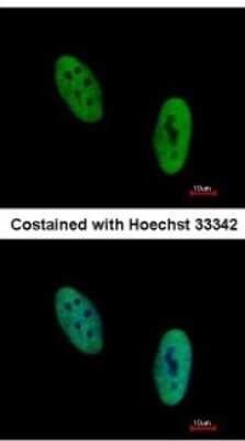 Immunocytochemistry/ Immunofluorescence: EWSR1 Antibody [NBP2-16389]