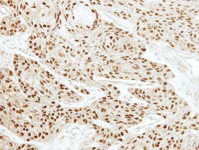 Immunohistochemistry-Paraffin: EWSR1 Antibody [NBP2-16389]