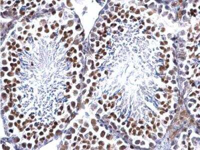 Immunohistochemistry-Paraffin: EWSR1 Antibody [NBP2-16389]