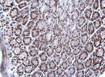Immunohistochemistry-Paraffin: EWSR1 Antibody [NBP2-16389]