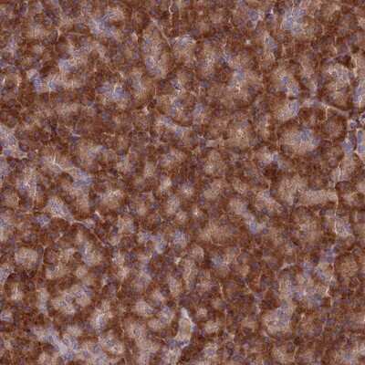 Immunohistochemistry-Paraffin: EXOC3L4 Antibody [NBP1-94124]