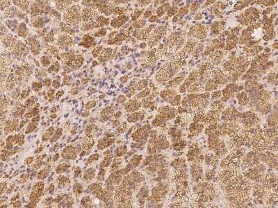 Immunohistochemistry: EXOC6 Antibody [NBP3-06304]