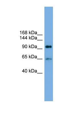Western Blot: EXOC6 Antibody [NBP1-55468]