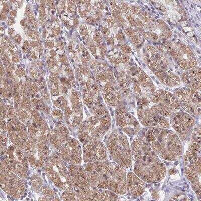 Immunohistochemistry-Paraffin: EXOC6B Antibody [NBP2-31869]