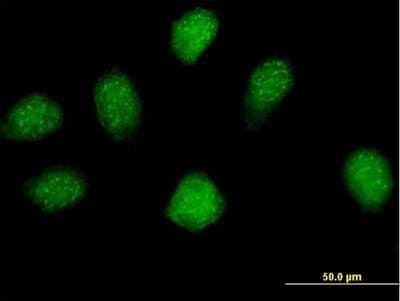 Immunocytochemistry/ Immunofluorescence: EXOD1 Antibody [H00112479-B01P]
