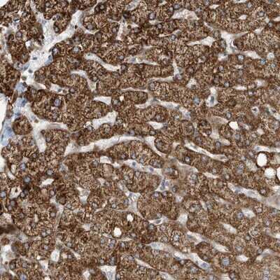 Immunohistochemistry-Paraffin: EXOD1 Antibody [NBP1-87941]