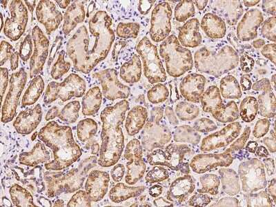 Immunohistochemistry-Paraffin: EXOD1 Antibody [NBP2-97773]