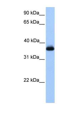 Western Blot: EXOD1 Antibody [NBP1-55303]
