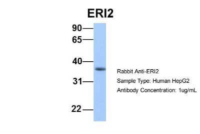 Western Blot: EXOD1 Antibody [NBP1-55303]