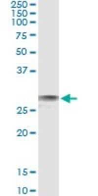 Immunoprecipitation: EXOSC3 Antibody (3E5) [H00051010-M11]