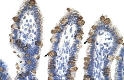 Immunohistochemistry-Paraffin: EXOSC3 Antibody [NBP1-57209]