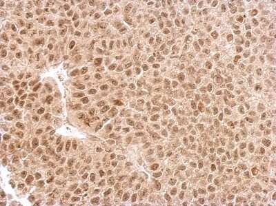 Immunohistochemistry-Paraffin: EXOSC3 Antibody [NBP2-16392]