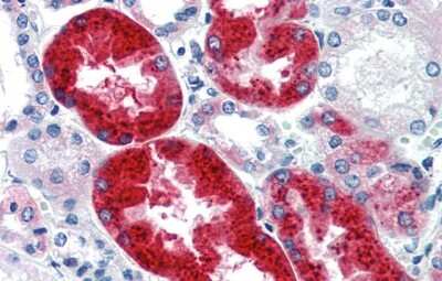 Immunohistochemistry: EYA1 Antibody [NBP2-87382]