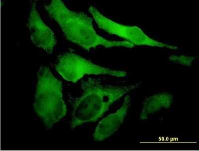 Immunocytochemistry/ Immunofluorescence: EYA2 Antibody (2F8) [H00002139-M04]