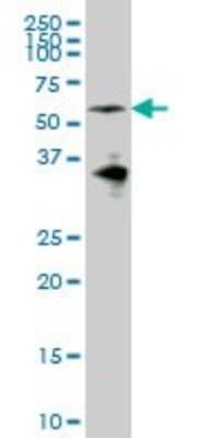 Western Blot: EYA2 Antibody (2F8) [H00002139-M04]