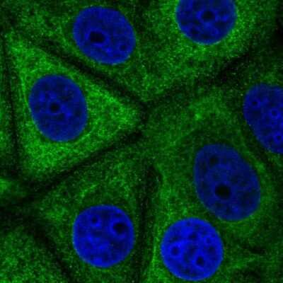 Immunocytochemistry/ Immunofluorescence: EYA2 Antibody [NBP2-57155]