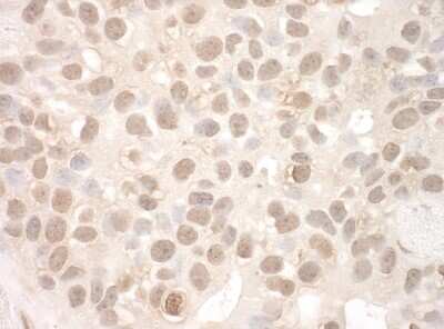 Immunohistochemistry-Paraffin: EYA2 Antibody [NBP1-46817]