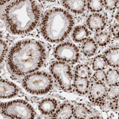 Immunohistochemistry-Paraffin: EYA2 Antibody [NBP1-84026]